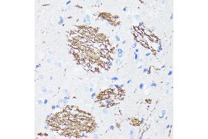 Immunohistochemistry (IHC) image for anti-Amyloid beta (A4) Precursor Protein (APP) antibody (ABIN7265575)