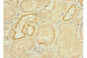 Immunohistochemistry of paraffin-embedded human kidney tissue using ABIN7166755 at dilution of 1:100 (DHX32 Antikörper  (AA 301-500))