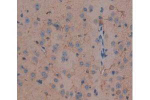 Used in DAB staining on fromalin fixed paraffin- embedded brain tissue (DLG5 Antikörper  (AA 1724-1917))