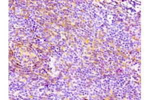 IHC image of ABIN7127280 diluted at 1:100 and staining in paraffin-embedded human lymph node tissue performed on a Leica BondTM system. (Rekombinanter CD4 Antikörper)