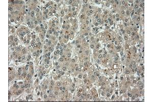 Image no. 10 for anti-Budding Uninhibited By Benzimidazoles 1 Homolog beta (Yeast) (BUB1B) antibody (ABIN1497000) (BUB1B Antikörper)