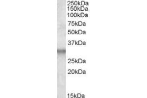 Image no. 1 for anti-Integral Membrane Protein 2B (ITM2B) (Internal Region) antibody (ABIN375095)