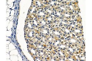 ABIN6260132 and ABIN6272482 at 1/100 staining mouse kidney tissue by IHC-P.