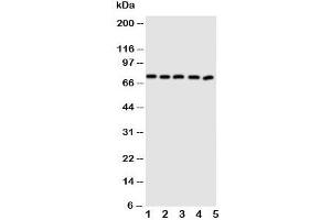Western blot testing of ABCG5 antibody and Lane 1:  MCF-7;  2: A549;  3: HT1080;  4: U87;  5: SKOV cell lysate. (ABCG5 Antikörper  (N-Term))