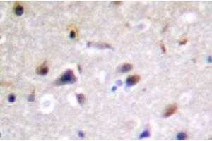 Image no. 2 for anti-Dystrophin Related Protein 2 (DRP2) antibody (ABIN317802) (DRP2 Antikörper)