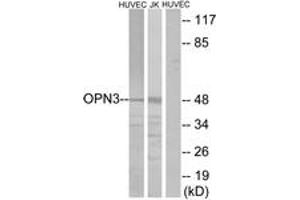 Western blot analysis of extracts from HuvEc/Jurkat cells, using OPN3 Antibody. (OPN3 Antikörper  (AA 161-210))