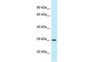 Image no. 1 for anti-Oligodendrocyte Transcription Factor 1 (OLIG1) (AA 96-145) antibody (ABIN6747872) (OLIG1 Antikörper  (AA 96-145))