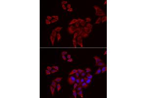 Immunofluorescence analysis of U2OS cells using P2RX4 antibody. (P2RX4 Antikörper)