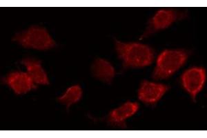 ABIN6267388 staining Hela by IF/ICC. (ATF2 Antikörper  (pSer94, pSer112))