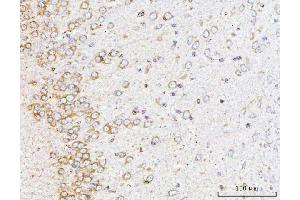 IHC analysis of YWHAE using anti-YWHAE antibody (ABIN7599165).