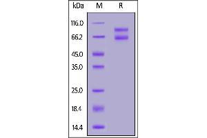 Biotinylated Human IL-2RB&IL-2RG Heterodimer Protein, Fc,Avitag&Fc,Avitag on  under reducing (R) condition.