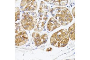 Immunohistochemistry (IHC) image for anti-Bone Morphogenetic Protein Receptor, Type II (serine/threonine Kinase) (BMPR2) (AA 27-150) antibody (ABIN7265906)