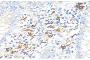 Immunohistochemistry of paraffin-embedded Human appendix using TPSAB1 Polyclonal Antibody at dilution of 1:100 (40x lens). (TPSAB1 Antikörper)