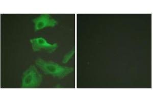 Immunofluorescence analysis of HeLa cells, treated with TNF-a (20nM, 15mins), using HSP90B (epitope around residue 254) antibody (ABIN5976154). (HSP90AB1 Antikörper  (Ser254))