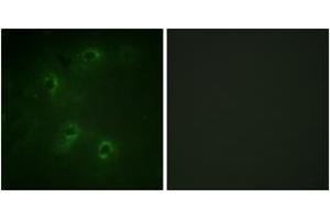 Immunofluorescence analysis of COS7 cells, using DAPK1 (Ab-308) Antibody. (DAP Kinase 1 Antikörper  (AA 274-323))