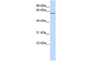 WB Suggested Anti-TRIM16 Antibody Titration:  0. (TRIM16 Antikörper  (N-Term))