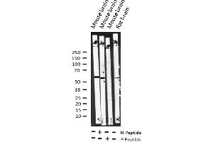 Western blot analysis of Phospho-Dab1 (Tyr232) expression in various lysates (DAB1 Antikörper  (pTyr232))