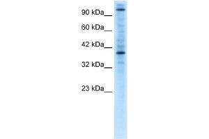WB Suggested Anti-ZNF624 Antibody Titration:  0. (ZNF624 Antikörper  (Middle Region))