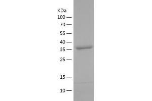 Western Blotting (WB) image for Alpha2 Antiplasmin (SERPINF2) (AA 380-491) protein (His-IF2DI Tag) (ABIN7121803) (alpha 2 Antiplasmin Protein (AA 380-491) (His-IF2DI Tag))