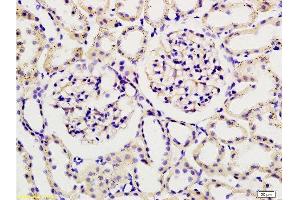 Formalin-fixed and paraffin embedded rat kidney tissue labeled with Rabbit Anti-Podoplanin/gp36 Polyclonal Antibody , Unconjugated 1:200 followed by conjugation to the secondary antibody and DAB staining (Podoplanin Antikörper  (AA 91-166))
