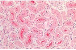 Immunohistochemistry analysis using Rabbit Anti-Tau Polyclonal Antibody (ABIN6698772). (tau Antikörper  (Biotin))