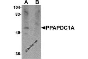 Western Blotting (WB) image for anti-Phosphatidic Acid Phosphatase Type 2 Domain Containing 1A (PPAPDC1A) (C-Term) antibody (ABIN1030596) (PPAPDC1A Antikörper  (C-Term))