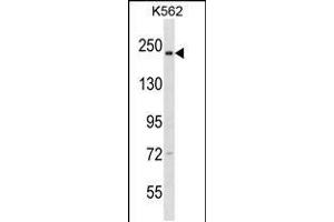 Western blot analysis in K562 cell line lysates (35ug/lane). (NCAPD3 Antikörper  (C-Term))