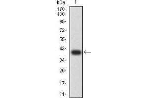 Western blot analysis using GRM5 mAb against human GRM5 (AA: extra 458-580) recombinant protein.