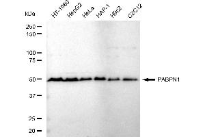Western blotting analysis using PABPN1 antibody (ABIN7797755).