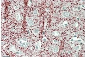 AP21274PU-N TPPP Antibody staining of paraffin embedded Human Cerebral Cortex at 3. (Tppp Antikörper  (Internal Region))