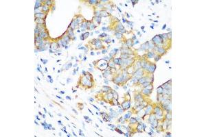 Immunohistochemistry of paraffin-embedded human stomach using MT-CO2 antibody (ABIN5997496) at dilution of 1/100 (40x lens). (COX2 Antikörper)