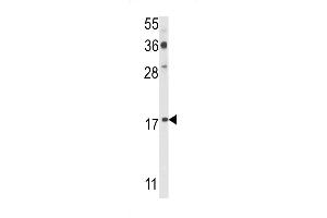 Western blot analysis of PDRG Antibody (N-term) (ABIN390943 and ABIN2841137) in  cell line lysates (35 μg/lane). (PDRG1 Antikörper  (N-Term))
