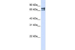 WB Suggested Anti-SF1 Antibody Titration:  0.