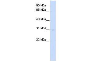 WB Suggested Anti-ZNF501 Antibody Titration:  0. (ZNF501 Antikörper  (C-Term))