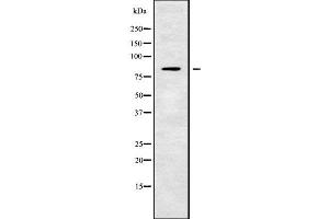 TMC7 Antikörper  (C-Term)