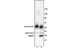 MGMT antibody (pAb) tested by Immunoprecipitation. (MGMT Antikörper  (C-Term))