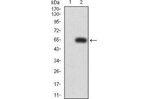Western blot analysis using P2RX7 mAb against HEK293 (1) and P2RX7 (AA: 226-452)-hIgGFc transfected HEK293 (2) cell lysate. (P2RX7 Antikörper  (AA 226-452))
