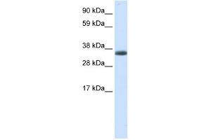 WB Suggested Anti-ERCC8 Antibody Titration:  0. (ERCC8 Antikörper  (N-Term))