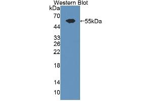 Western blot analysis of the recombinant protein. (ADAMTS13 Antikörper  (AA 896-1131))
