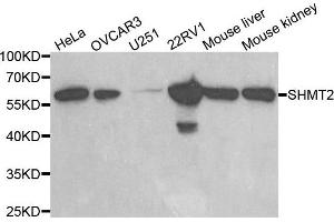 Western blot analysis of extracts of various cell lines, using SHMT2 antibody. (SHMT2 Antikörper)