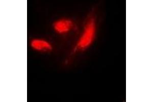 Immunofluorescent analysis of IRF3 (pS385) staining in HeLa cells.