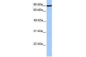 WB Suggested Anti-ADAM2 Antibody Titration: 0. (ADAM2 Antikörper  (Middle Region))