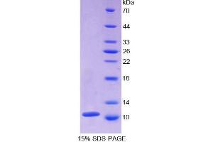 SDS-PAGE analysis of Mouse beta Thromboglobulin Protein.