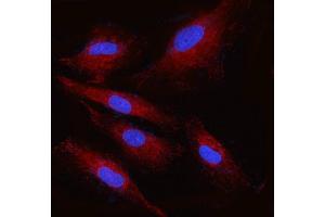 IF analysis of RPN2 using anti-RPN2 antibody (ABIN7602211). (Ribophorin II Antikörper  (AA 64-174))