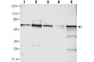 Western blot analysis of Lane 1: RT-4, Lane 2: U-251 MG, Lane 3: A-431, Lane 4: Liver, Lane 5: Tonsil with UPF3B polyclonal antibody  at 1:250-1:500 dilution.