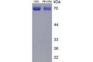 Image no. 1 for Dipalmitin protein (HSA) (ABIN1880222) (Dipalmitin Protein (HSA))