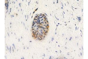 anti-Keratin 81 (KRT81) (C-Term) antibody