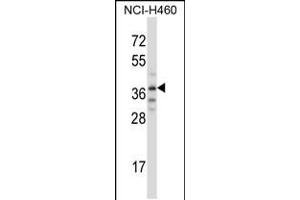 Western blot analysis in NCI-H460 cell line lysates (35ug/lane). (TRIM31 Antikörper  (C-Term))