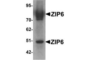 Western blot analysis of ZIP6 in mouse lung tissue lysate with ZIP6 antibody at 1 μg/ml. (SLC39A6 Antikörper  (Center))
