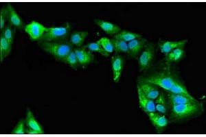 Immunofluorescence (IF) image for anti-Myosin Binding Protein C, Fast Type (MYBPC2) (AA 739-1141) antibody (ABIN7160604)